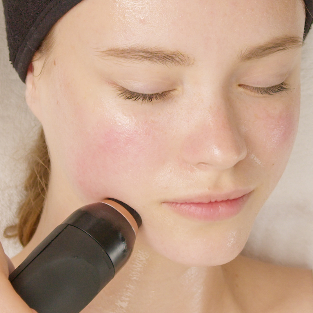 Geneo X radiofrequency skin tightening technology used at our St Leonards clinic