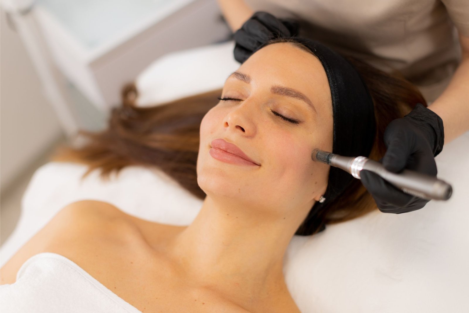 Skin needling treatment in St Leonards